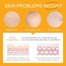 Conjunto Completo de Skin Care LAIKOU